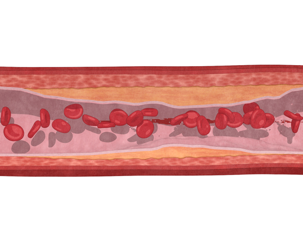 NattoPharma, MenaQ7 – Arteries & K2